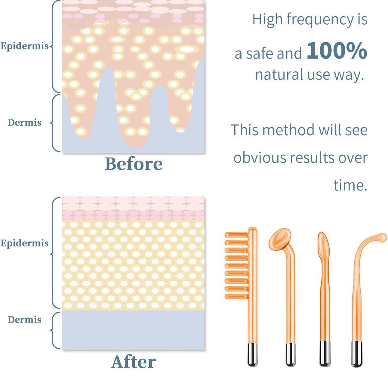 Appareil à Haute Fréquence TUMAKOU - Stimulation Faciale Santé - Image 5